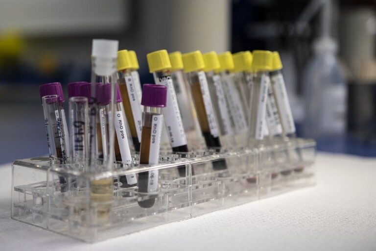 Coronavirus, test sierologici in Toscana: a chi saranno fatte le analisi del sangue
