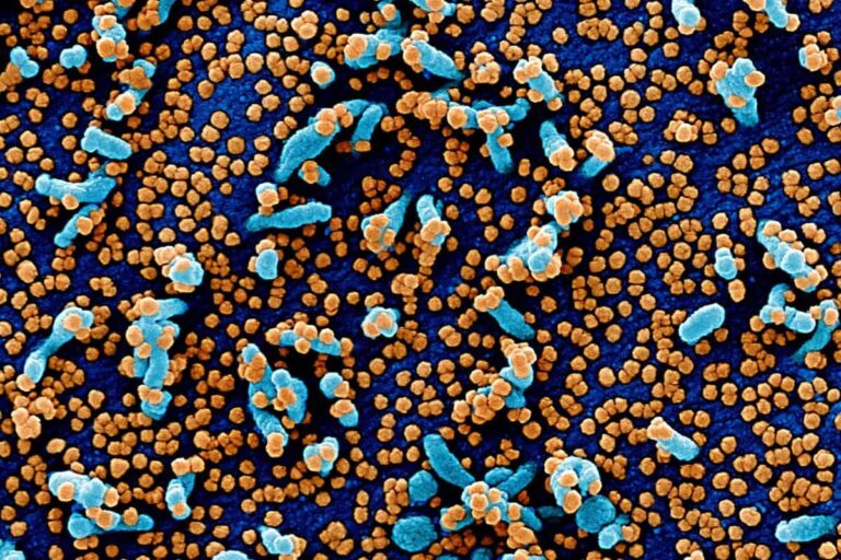 Coronavirus, 138 nuovi casi in Toscana: i dati di oggi, 12 settembre
