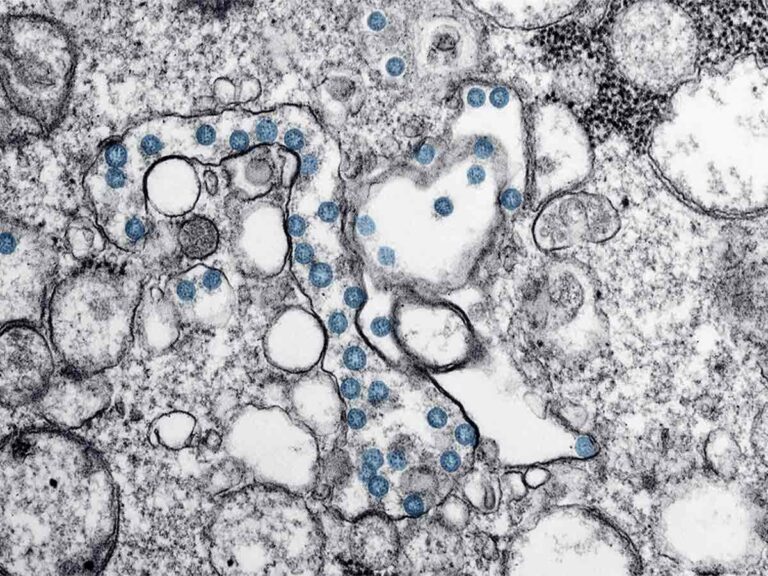 Coronavirus in Toscana, frena il contagio: 196 casi e 13 morti