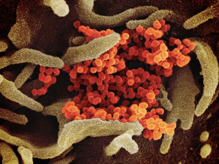 I sintomi del coronavirus