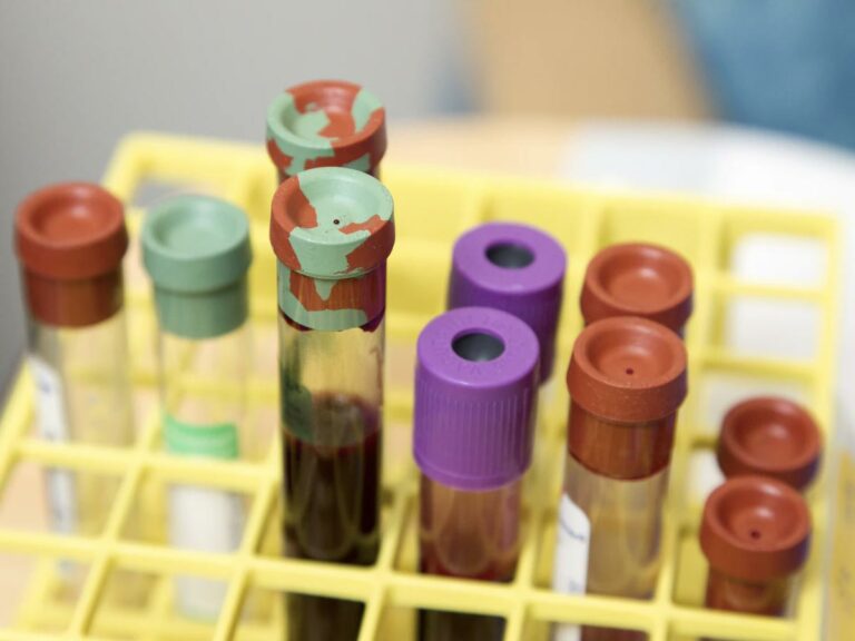 Firenze: al via test sierologico del coronavirus per tutti, prenotazione online