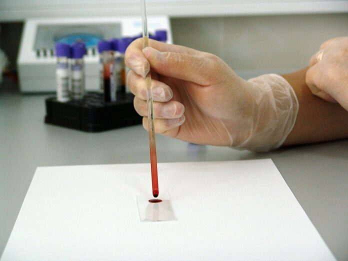 Test sierologici coronavirus Toscana dove fare elenco laboratori privati
