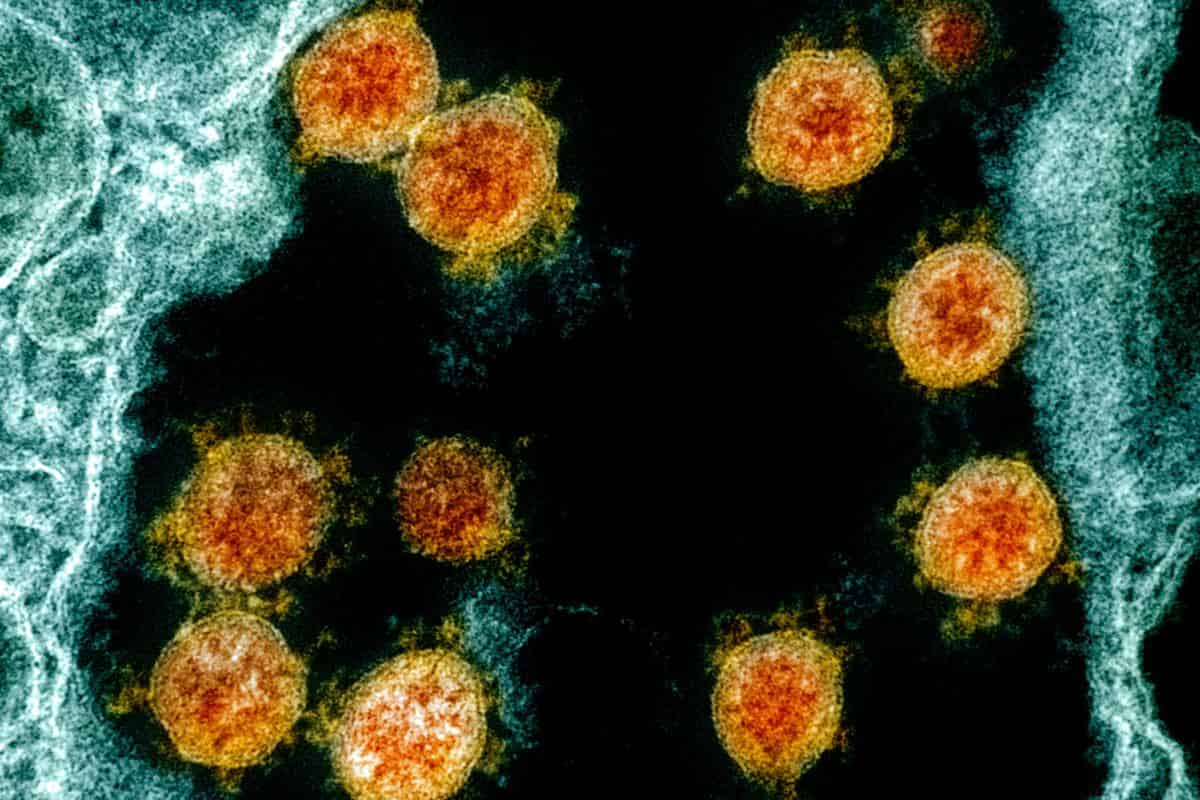 Covid Toscana contagi 2 febbraio 2021 bollettino regione coronavirus