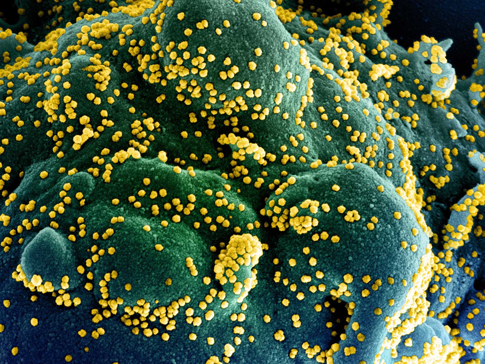 Covid Toscana oggi contagi casi bollettino coronavirus 3 maggio 2021